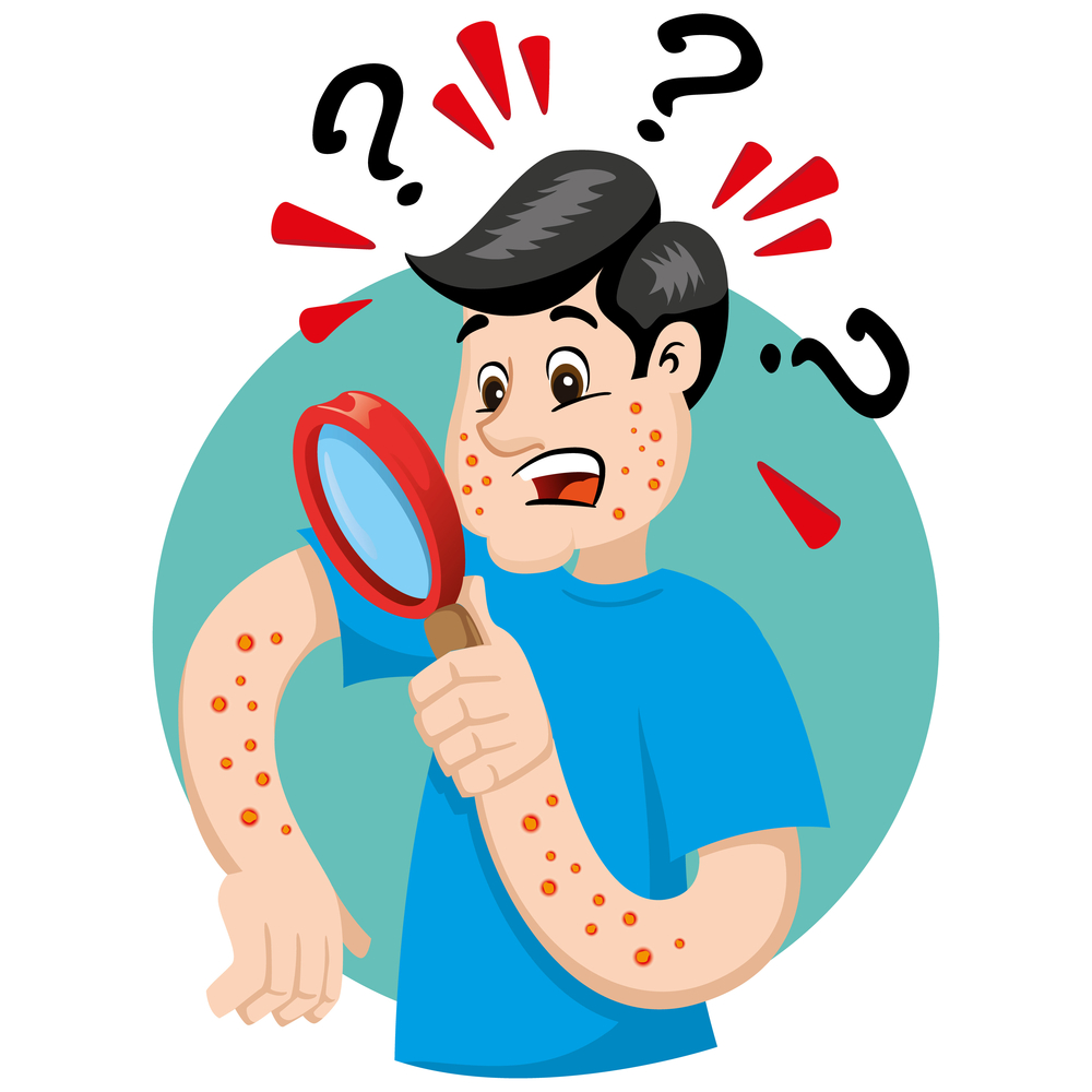 Signs of Eczema Infection Eczema infection Symptoms