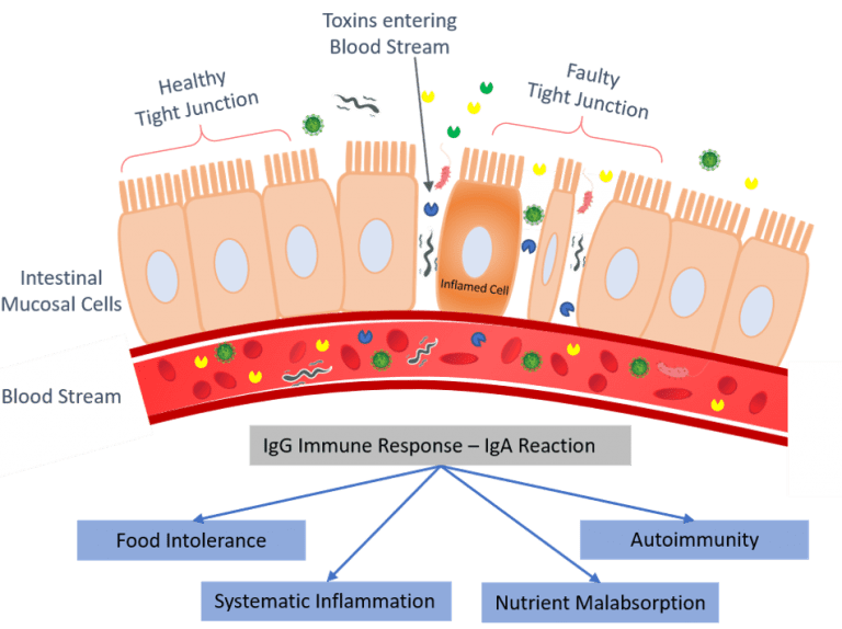 Leaky gut syndrome исследования