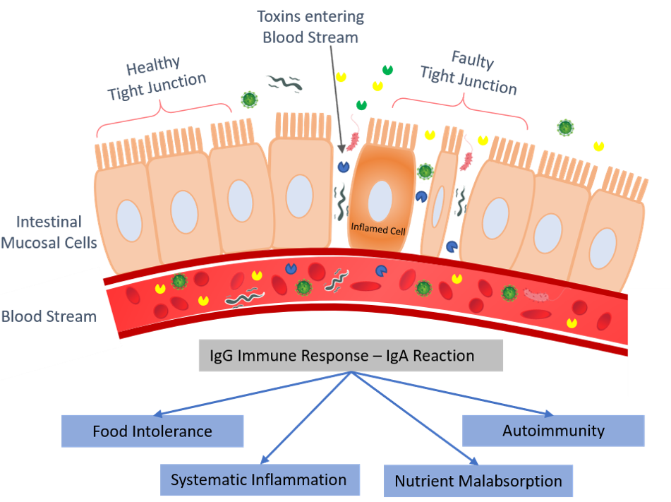 What happens in leaky gut