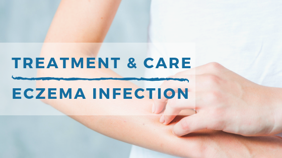 Treatment & Care for Eczema Infections