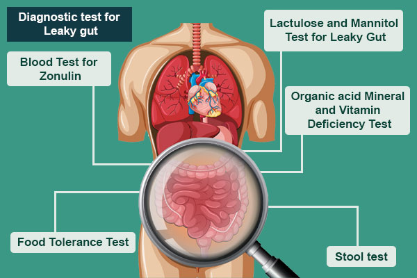 Diagnosis of Leaky Gut