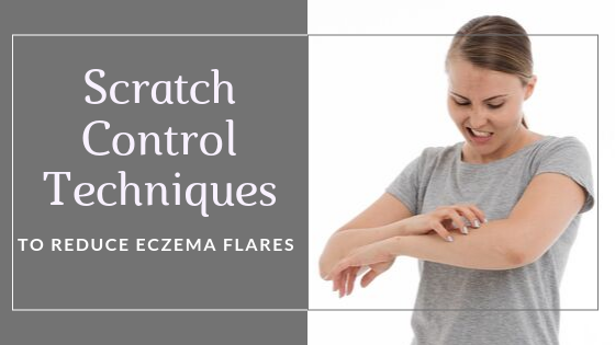 Reducing eczema flares using scratch control techniques