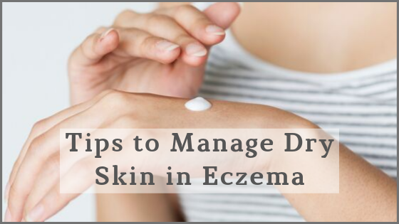 Managing Skin Dryness in Eczema