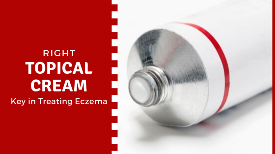 Topical Creams to treat Eczema