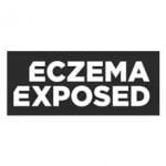 Eczema Exposed