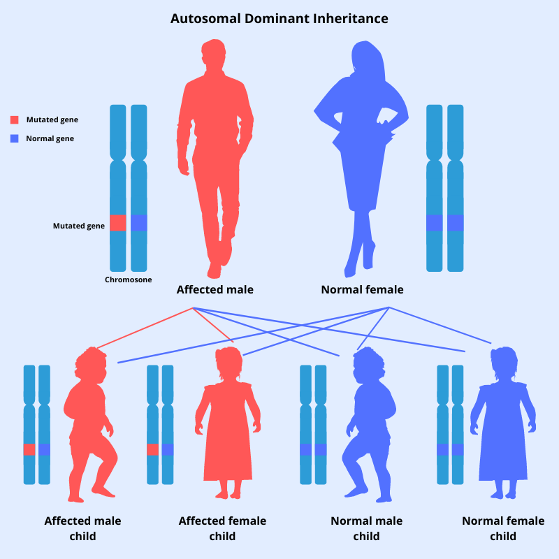 Autosomal dominant inheritance pattern