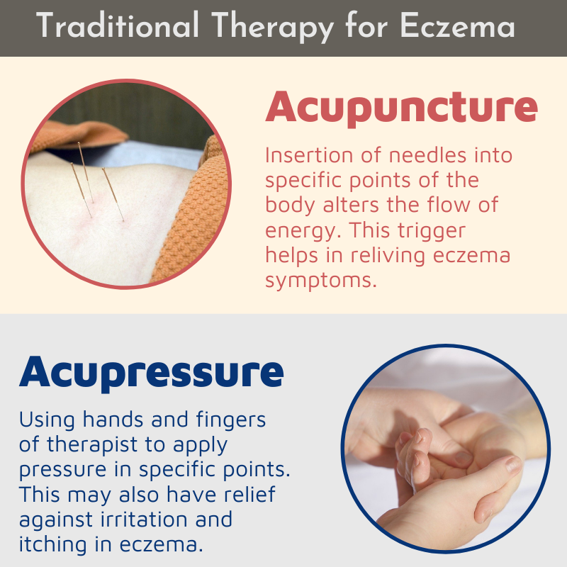 Natural therapy for eczema