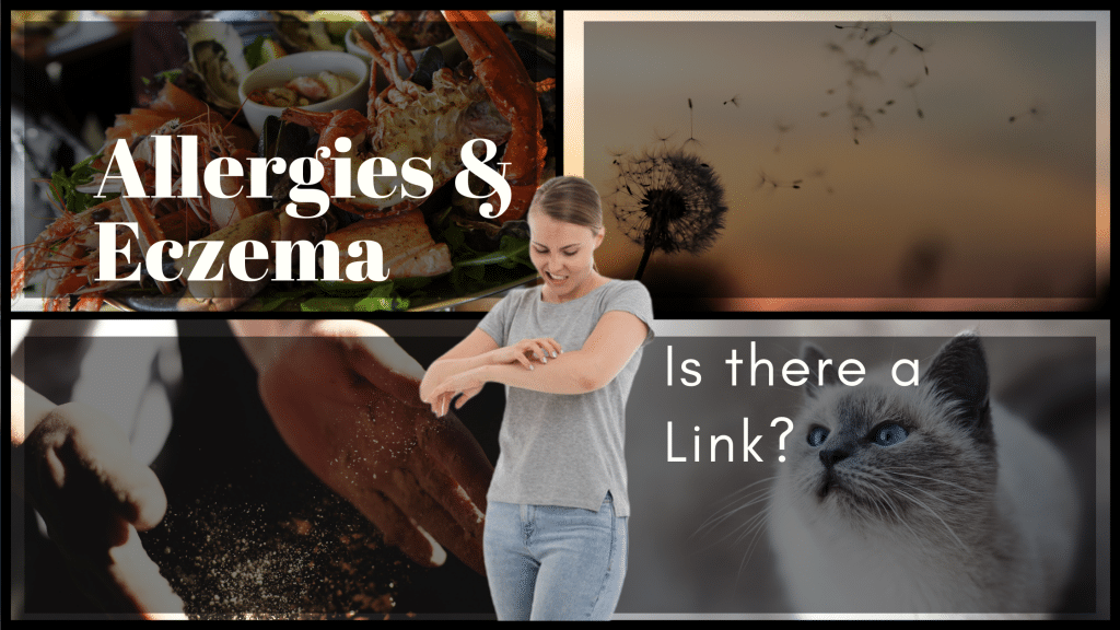 Allergies and Eczema – Is there a link?