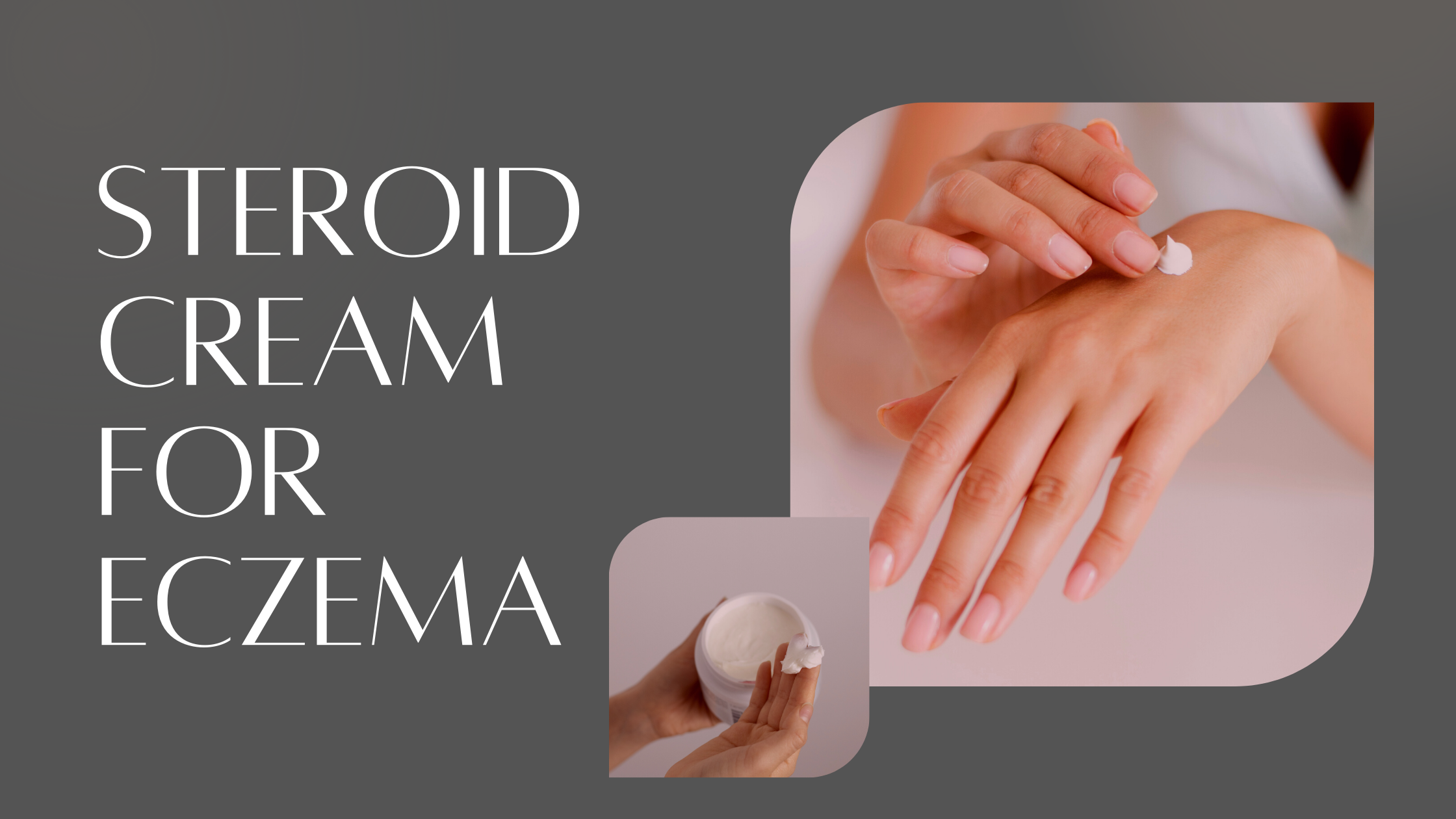 Steroid cream for Eczema