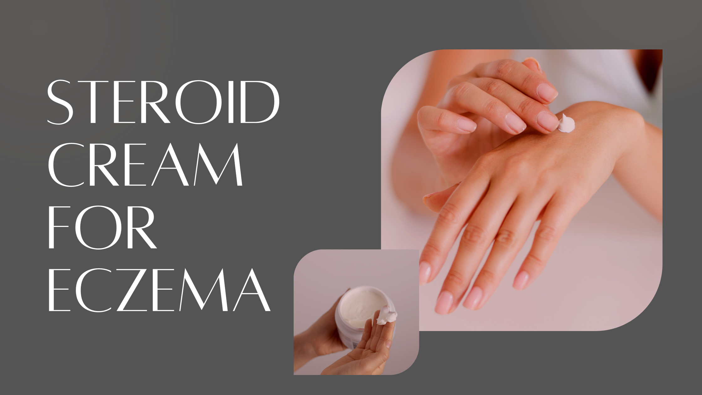 Steroid Cream For Eczema Eczemaless