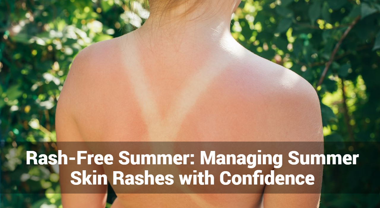 صيف خالٍ من الطفح الجلدي: إدارة الطفح الجلدي الصيفي بثقة