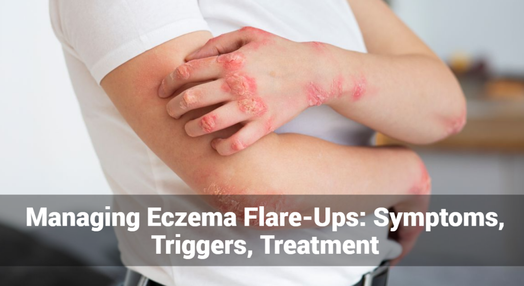 Managing Eczema Flare-Ups: Symptoms, Triggers, Treatment | Eczemaless