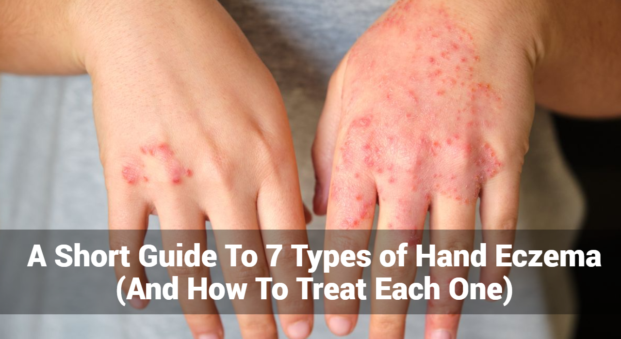 7 種手部濕疹的簡短指南（以及如何治療每種濕疹）