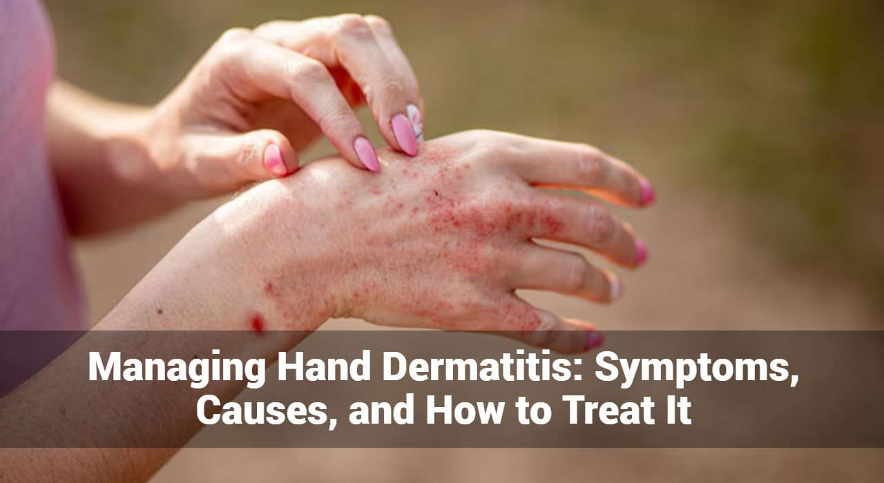 手部皮膚炎的治療：症狀、原因和治療方法
