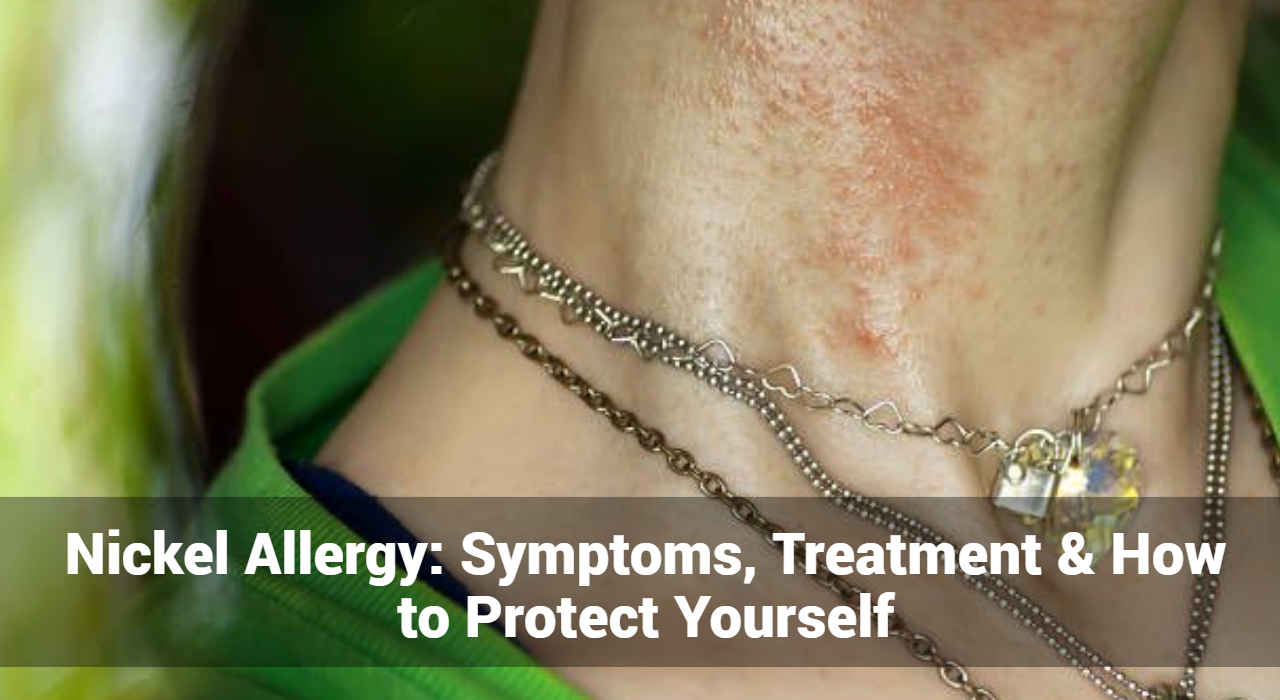 Nikkelallergie: symptomen, behandeling en hoe u uzelf kunt beschermen